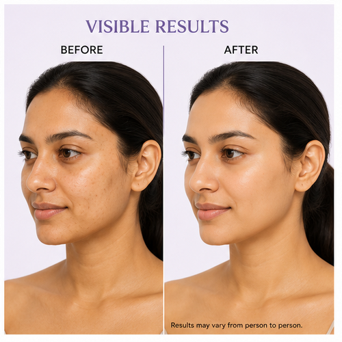Glowplix 0.2% Retinol Cream for All Skin Types, 50 g