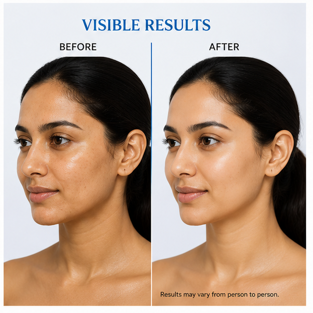 Glowplix Moisturizer Cream for All Skin Types, 50 g