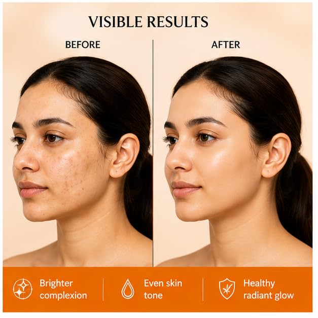Glowplix 10% Vitamin C Brightening Serum for All Skin Types, 30 ml